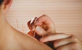 Hvordan virker akupunktur?